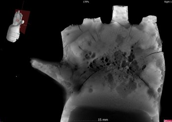 3500 Jahre im Boden haben Spuren hinterlassen. Das Schichtröntgenbild zeigt, wie korrodiert die Bronzehand im Innern ist. © Qualitech AG, Daniel Galsterer.